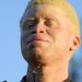 ORIGIN, PLIGHT AND BEAUTY OF ALBINOS